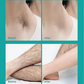 Painless Full Body Hair Removal Cream for Men & Women