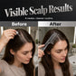 🎁Buy 1 Get 1 Free✨ 2026 Sale - Over 31,800 Sold! - Scalp Applicator Comb Tool for Hair